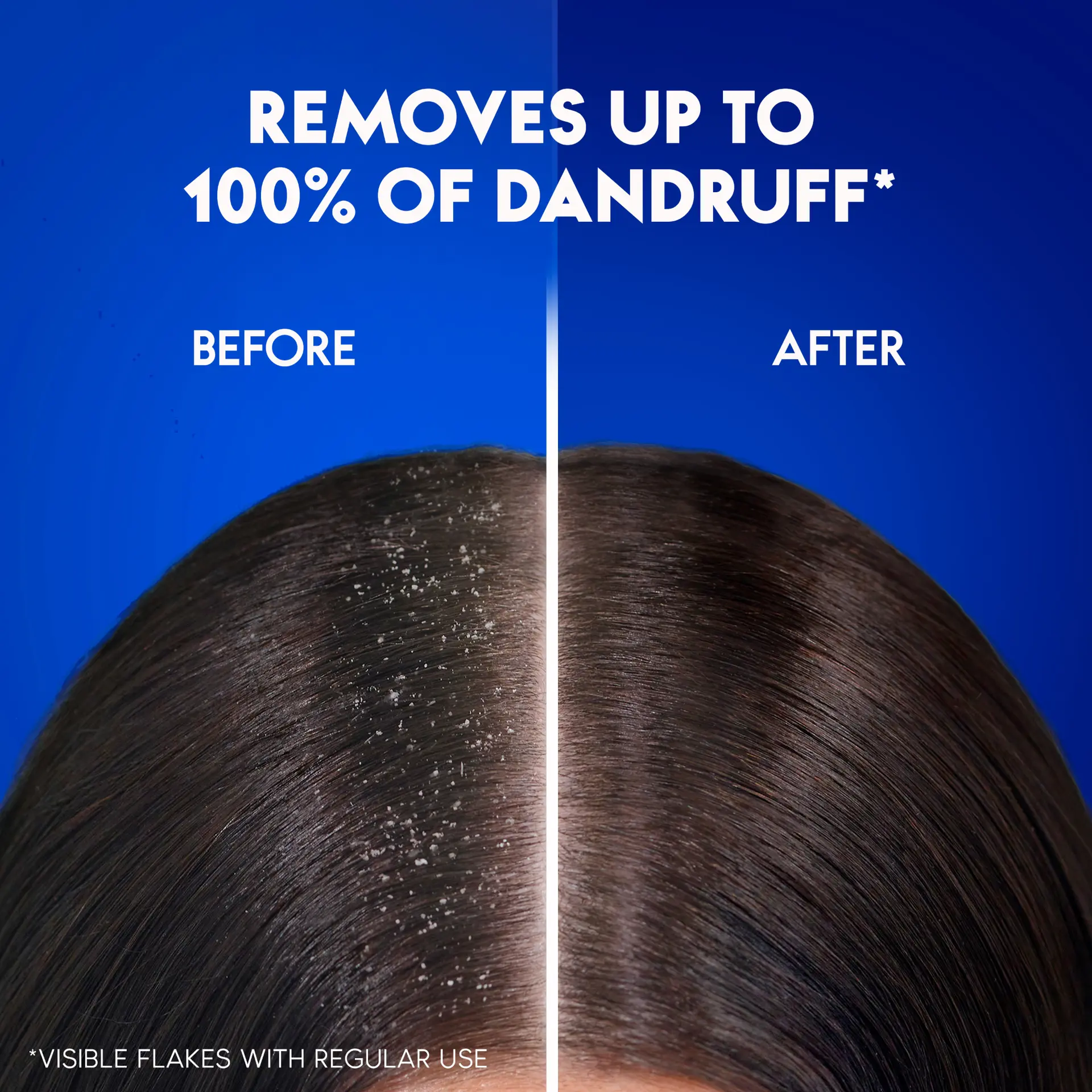 Head & Shoulders Menthol Refresh Anti-Dandruff Shampoo for Itchy Scalp 600 ml - view 6