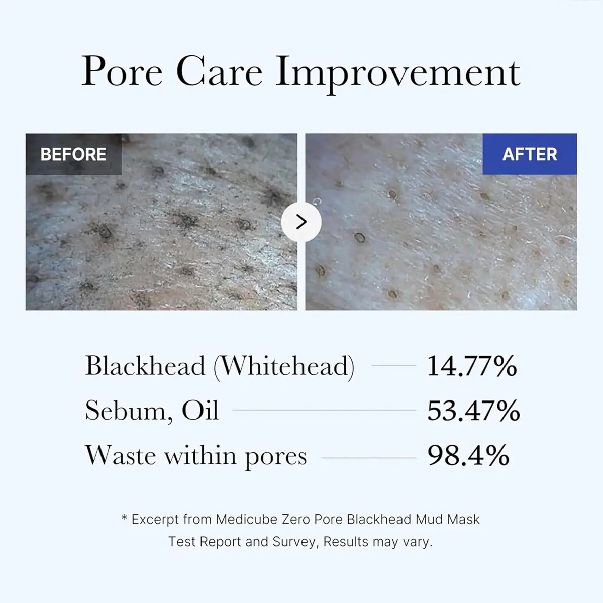Medicube Zero Pore Blackhead Mud Mask 100 gm - view 8