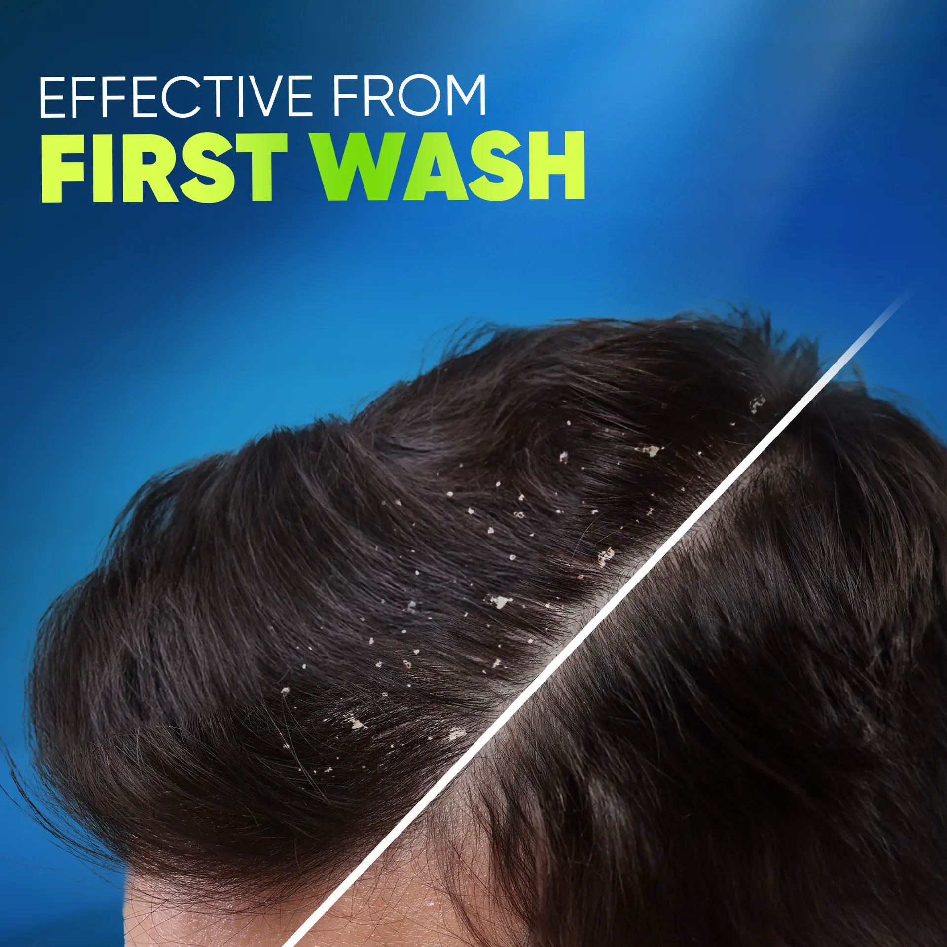 Head & Shoulders Deep Clean For Severe Oily Scalp Anti-Dandruff 400 ml  - view 6