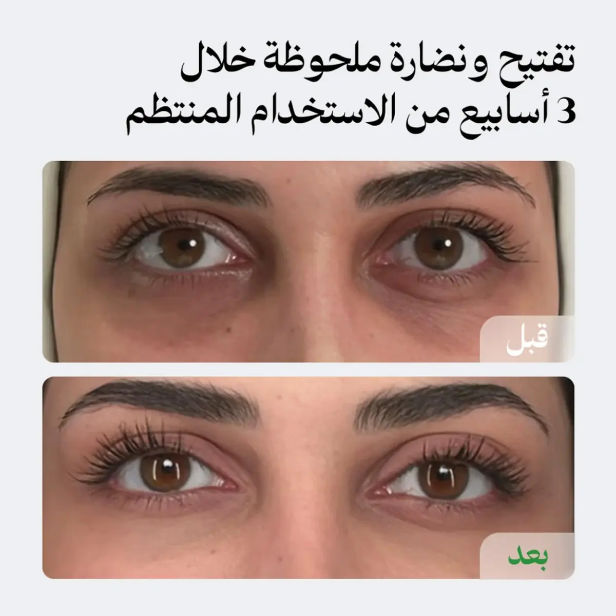 لونيل كريم الهالات للتفتيح والنضارة 30 مل - view 5