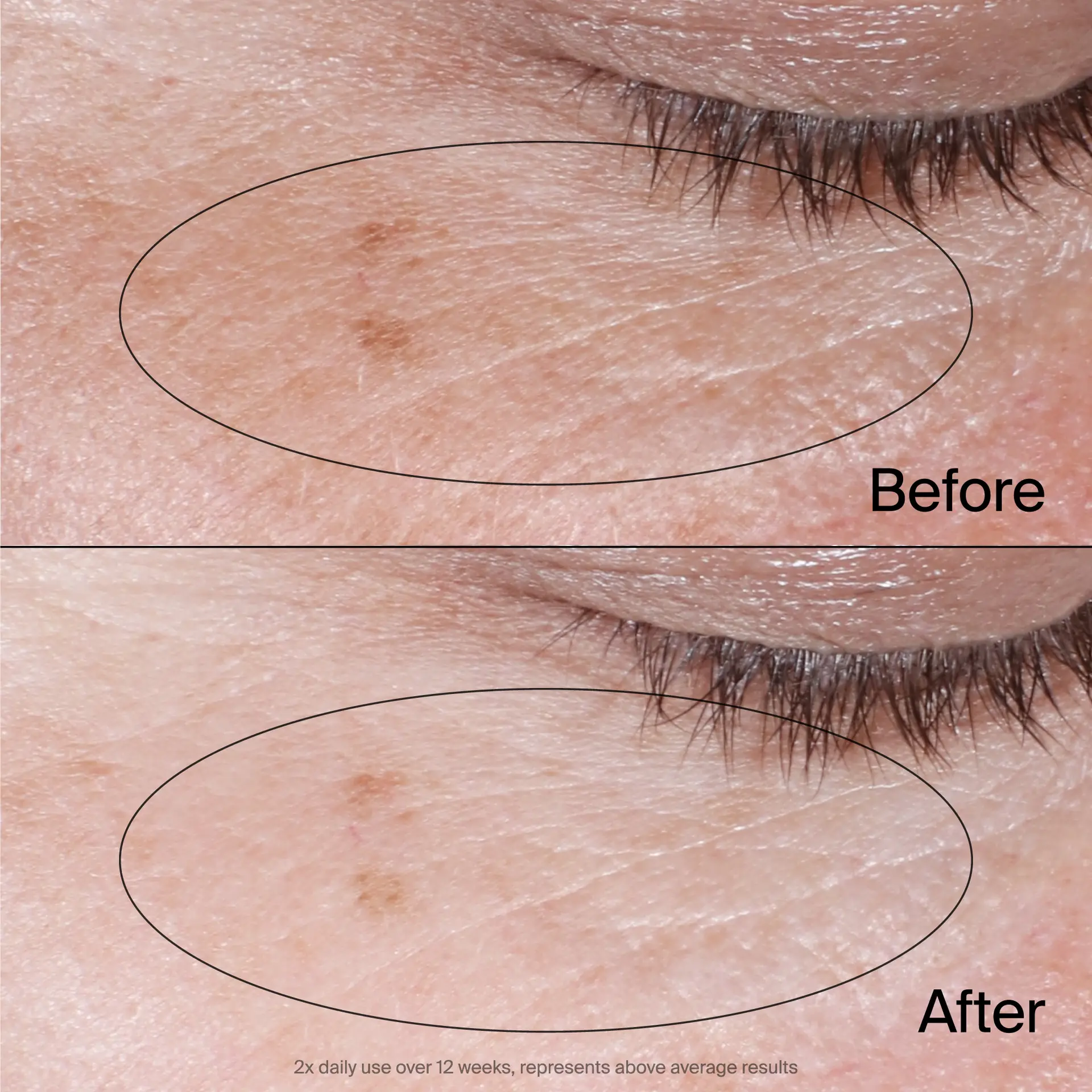 Neutrogena Collagen Bank Eye Cream 15 ml - view 6
