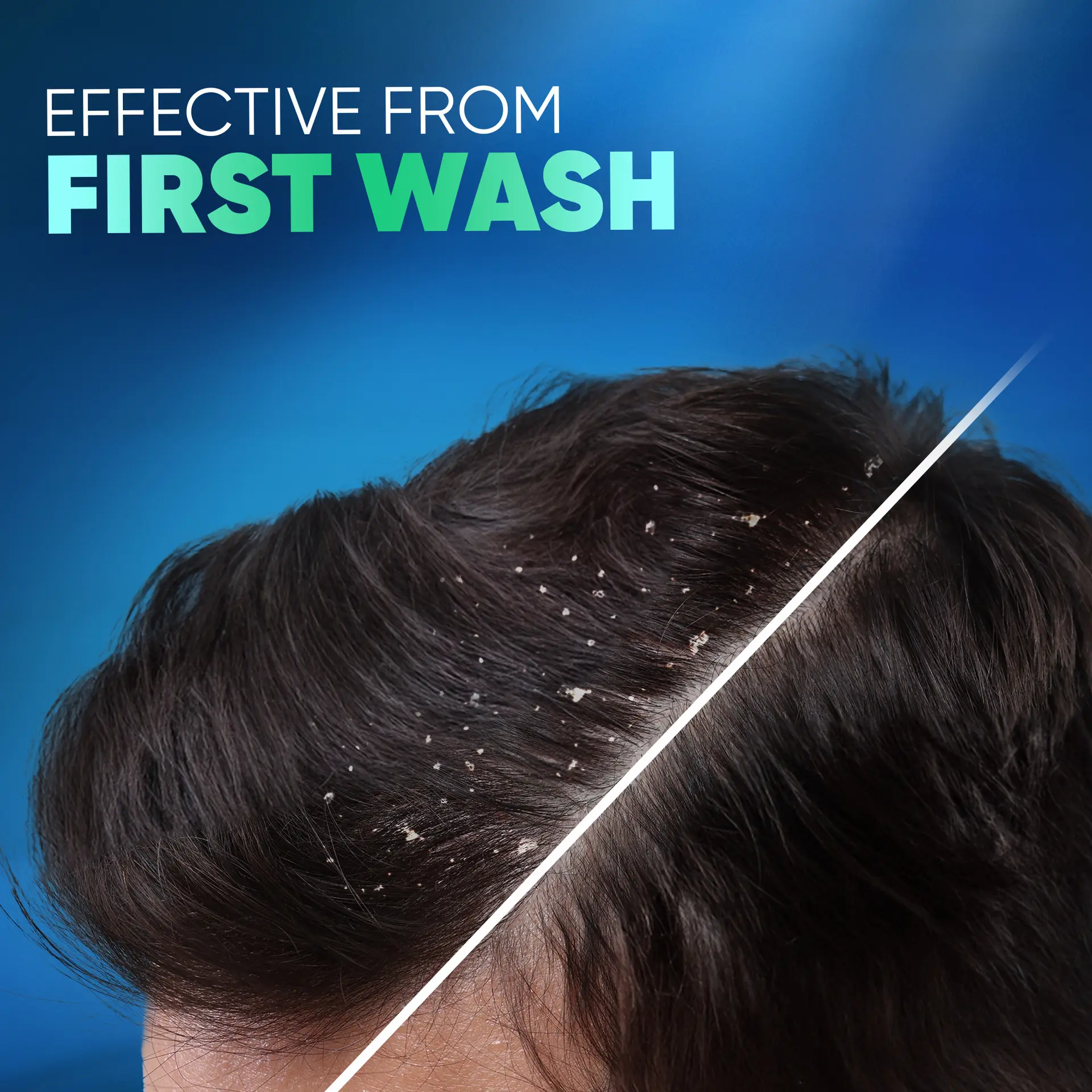 Head & Shoulders Deep Clean For Severe Itchy Scalp Anti-Dandruff 400 ml   - view 6