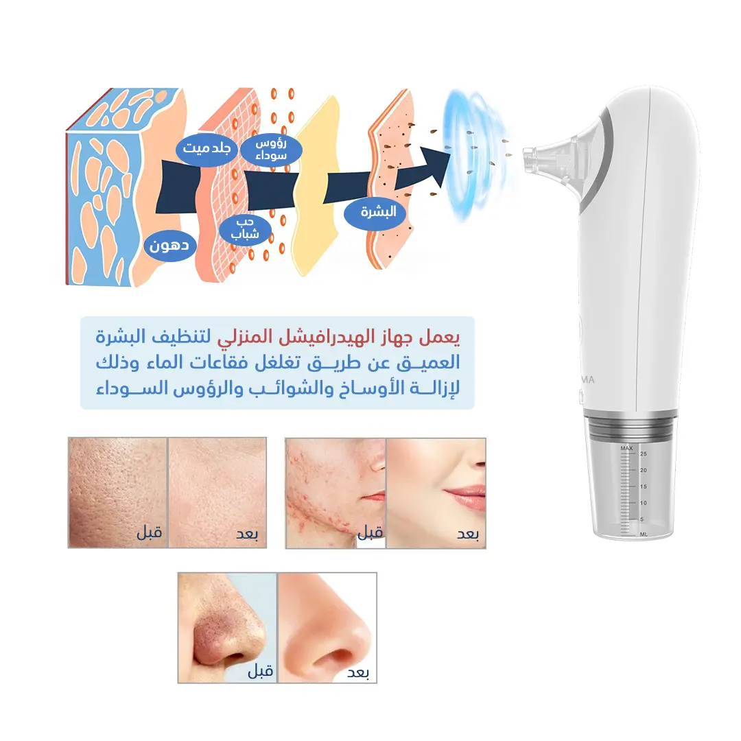 Jevma Deep Cleaning Device - view 8