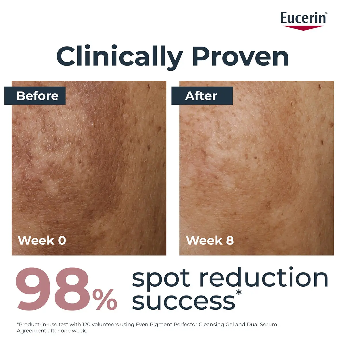 Eucerin Even Pigment Perfector Dual Face Serum 30ml - view 6