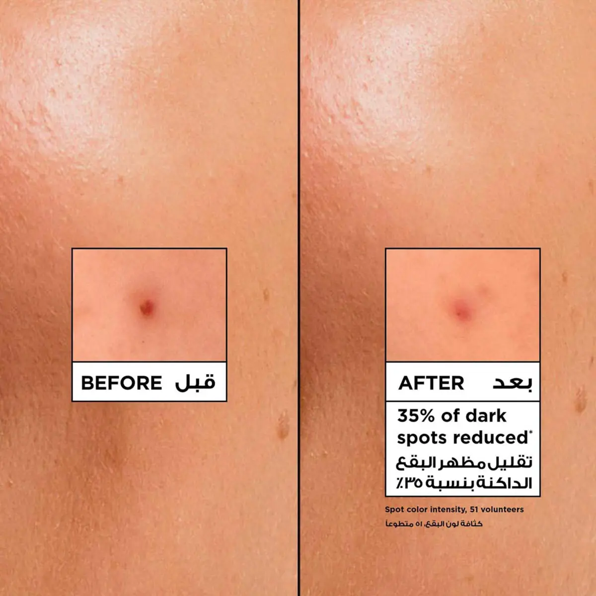 غارنييه سكين أكتيف فيتامين سي كريم إنتعاش وإشراقة 85 مل - view 9