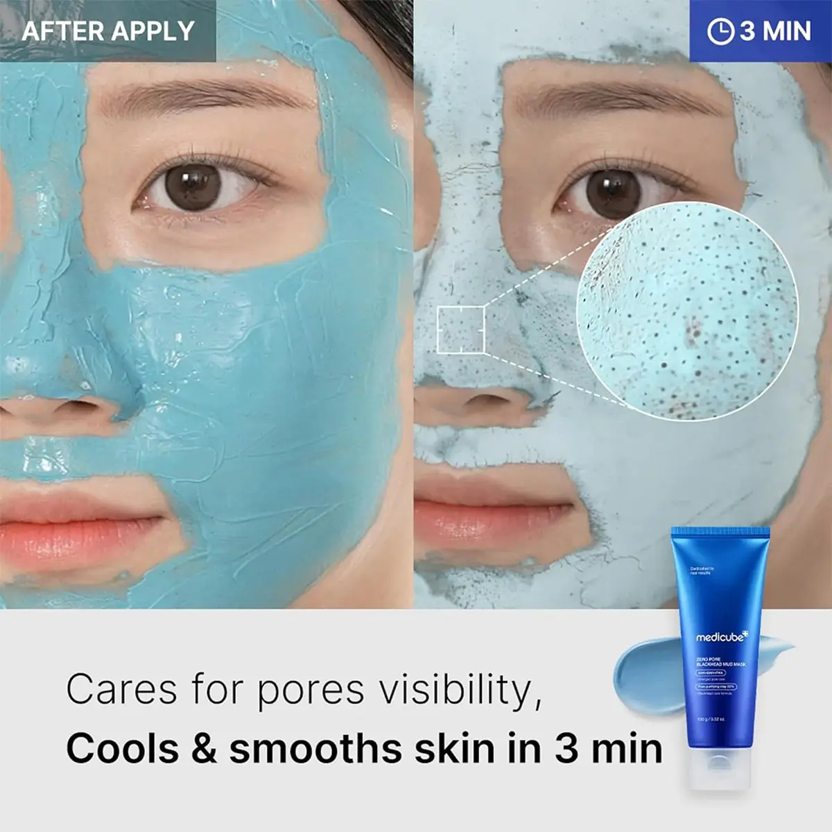 Medicube Zero Pore Blackhead Mud Mask 100 gm - view 12