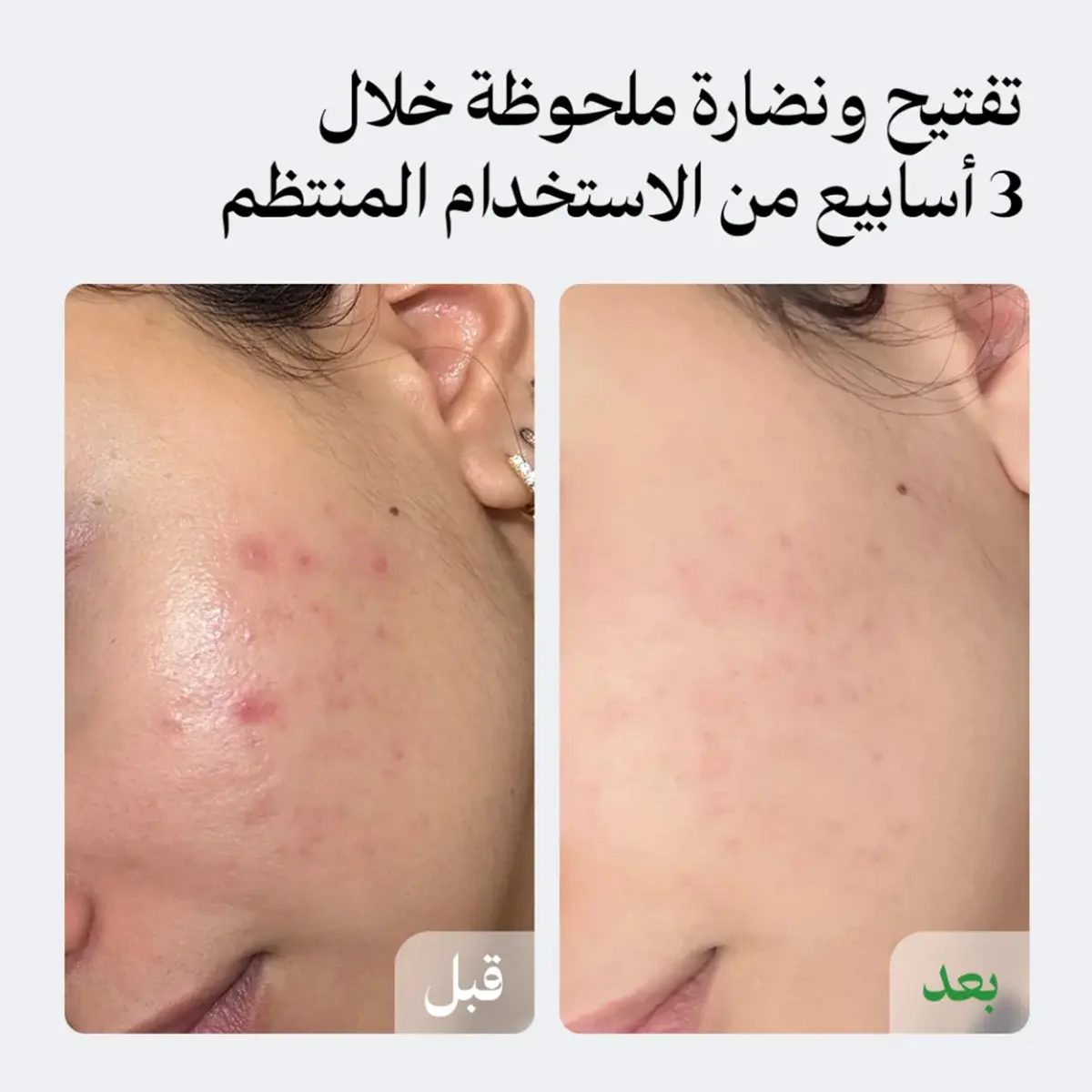لونيل سيروم التفتيح والنضارة 30 مل - view 5