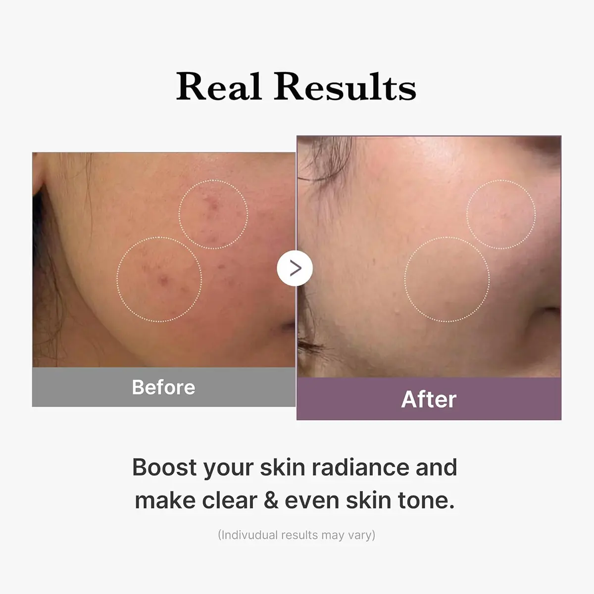 Medicube Age-R Glutathione Glow Toner 140Ml - view 9