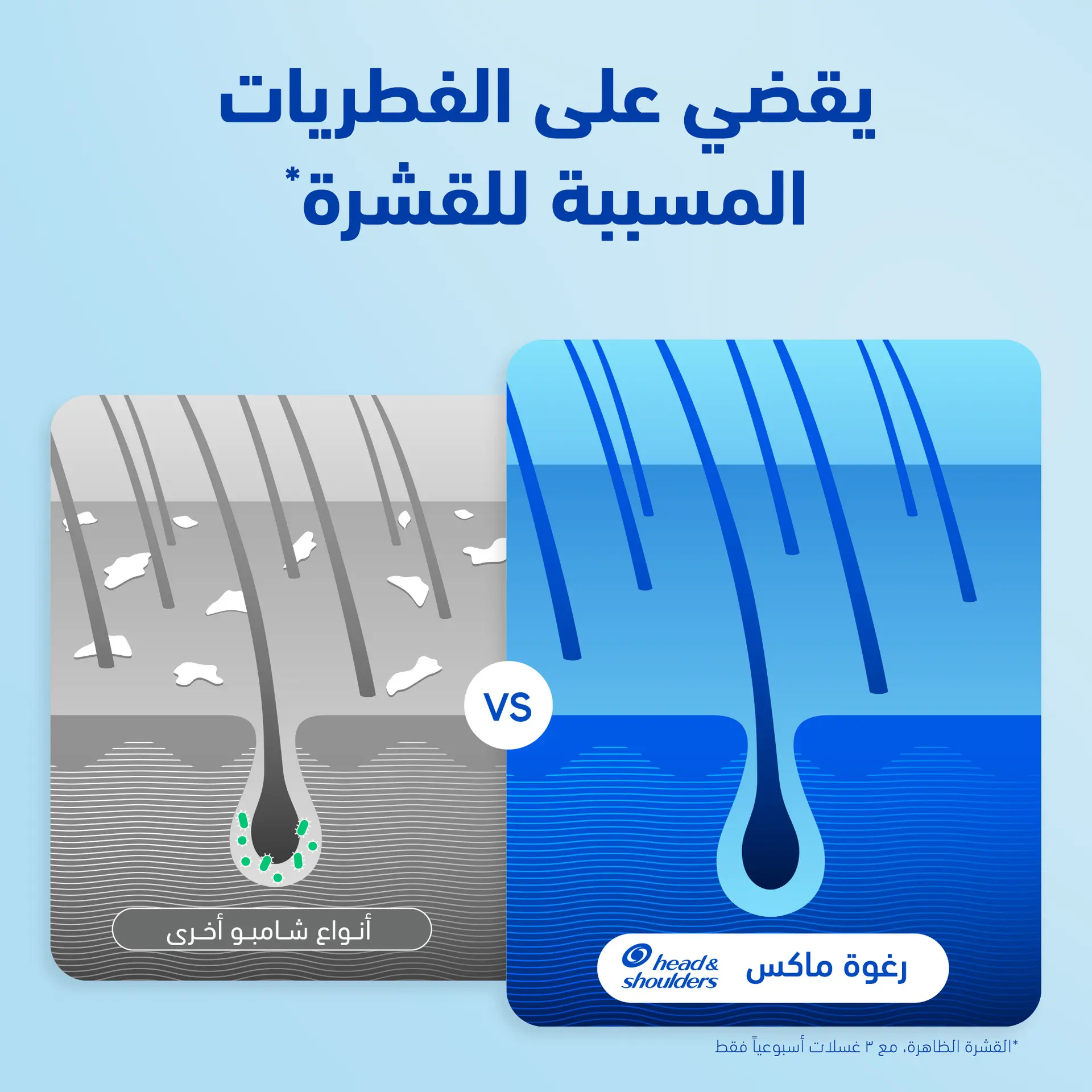 Head & Shoulders Extra Volume Anti Dandruff Shampoo Volumizes Fine And Limp Hair 500 ml - view 4