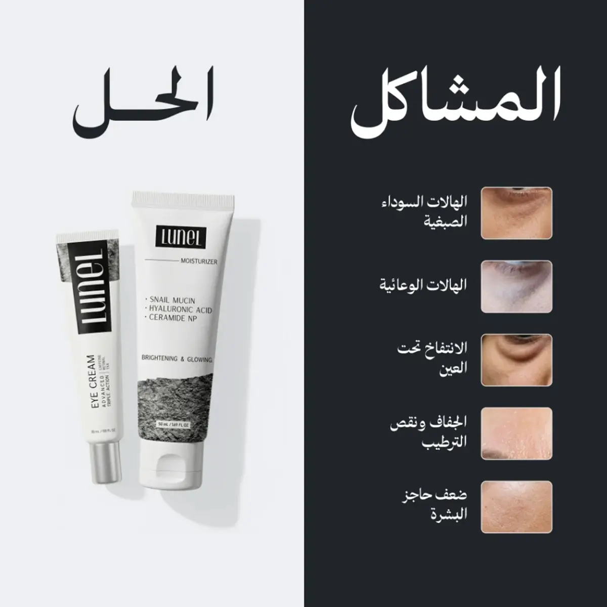 لونيل مجموعة الهالات والترطيب (كريم الهالات 30 مل + مرطب 50 مل) - view 5