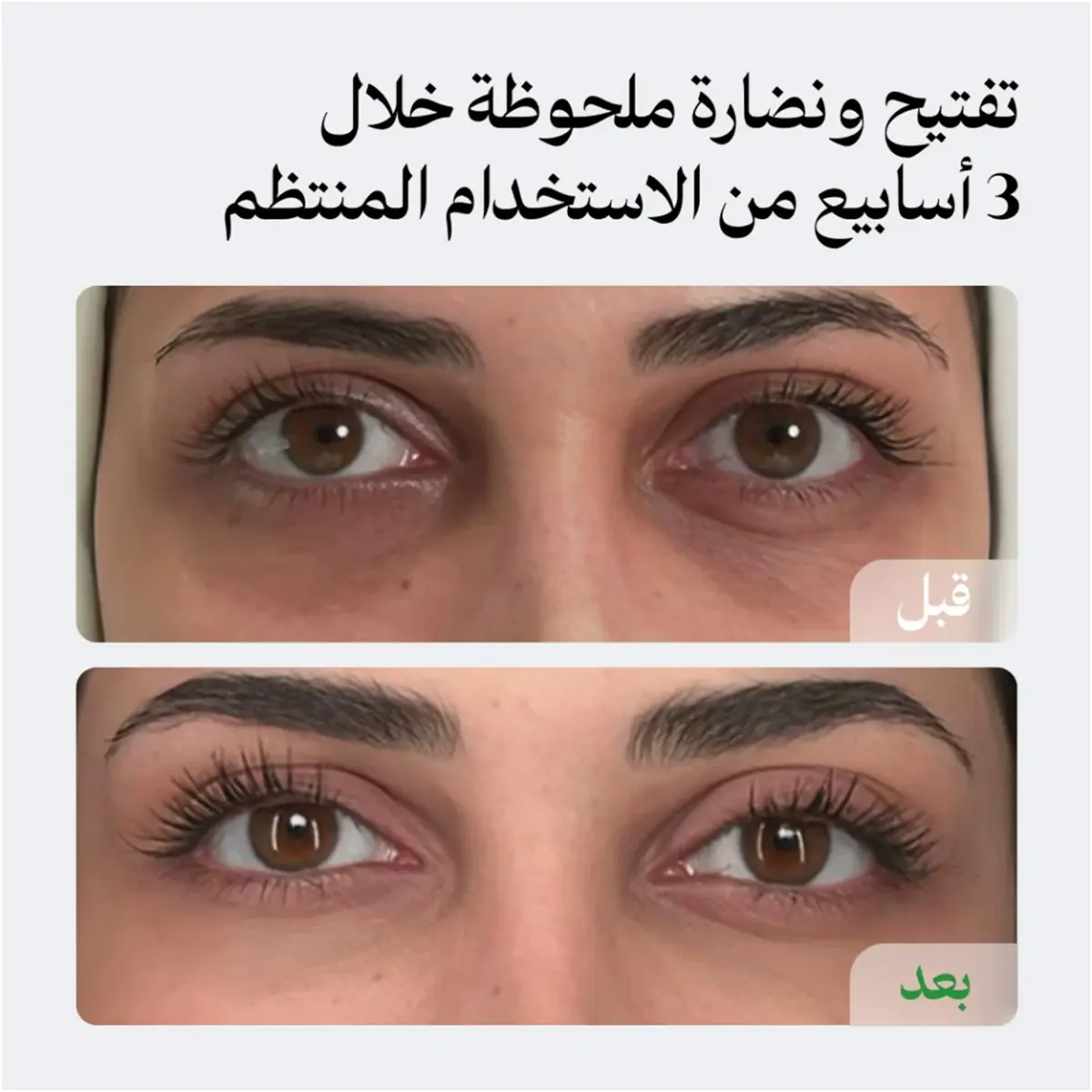 لونيل مجموعة الهالات والترطيب (كريم الهالات 30 مل + مرطب 50 مل) - view 6