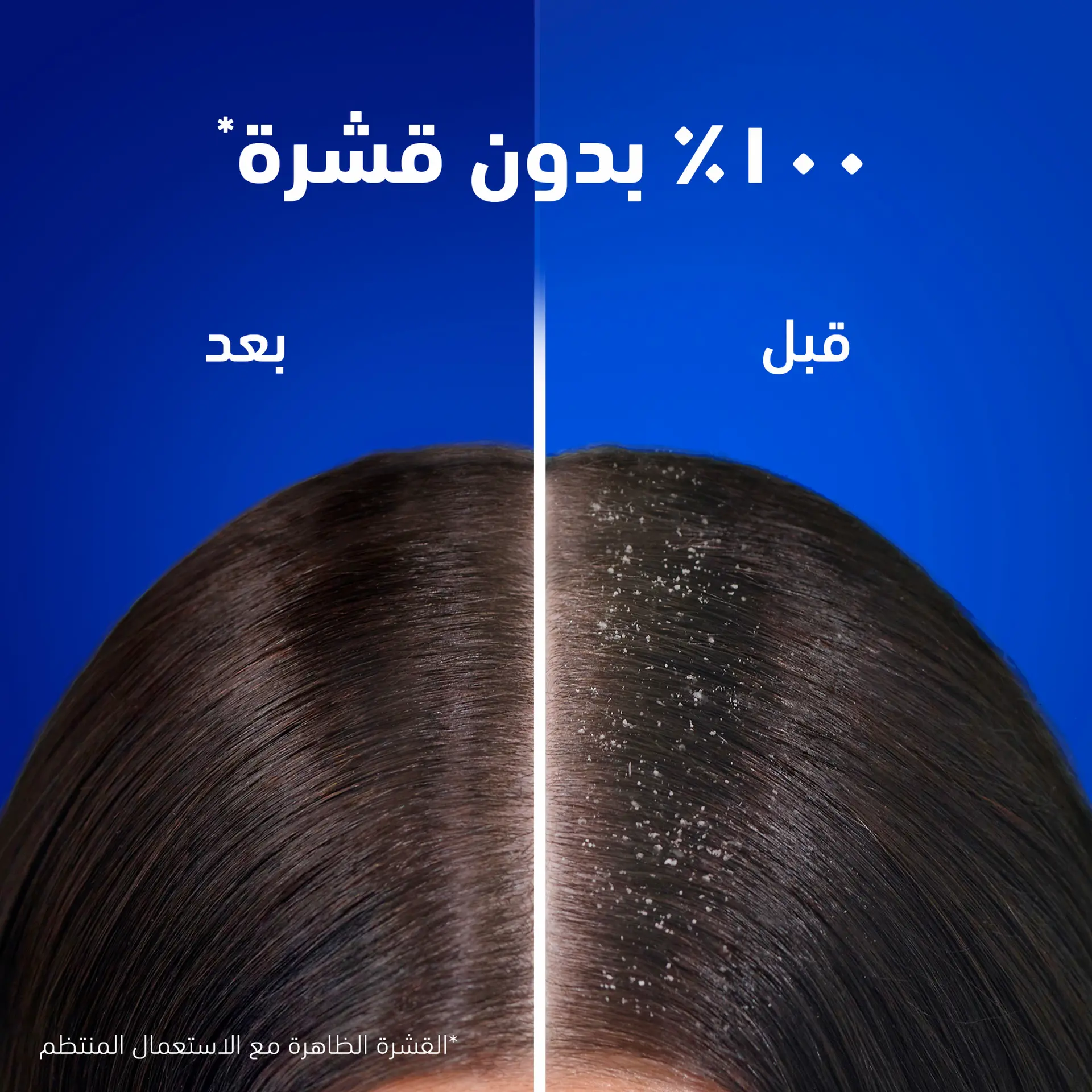 Head & Shoulders Shampoo Classic And Clean 400ML - view 2