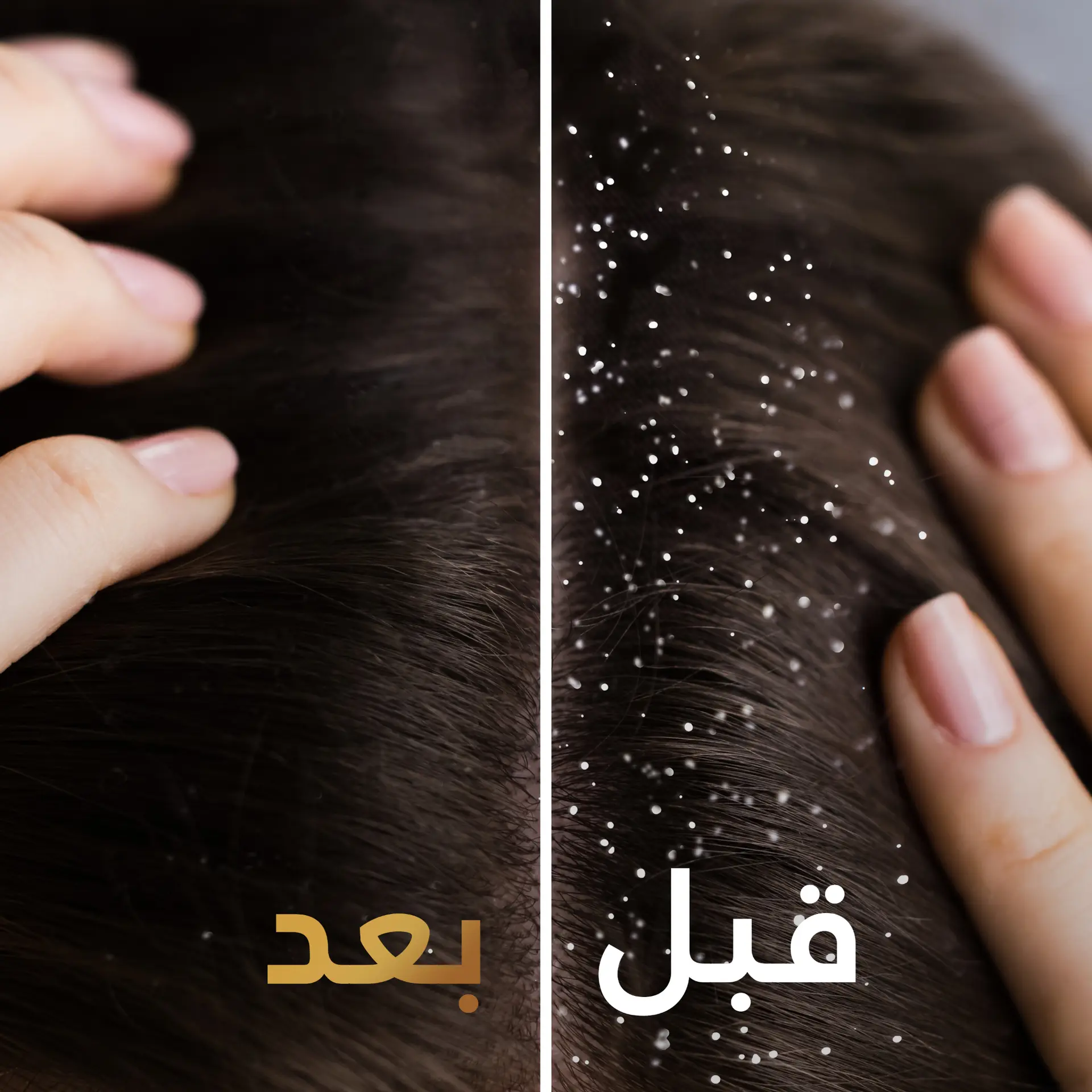 Pantene Shampo Anti Dandruff 190 ml - view 5