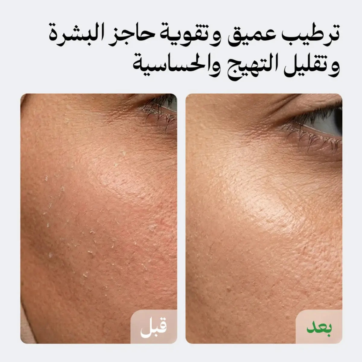 لونيل مجموعة الهالات والترطيب (كريم الهالات 30 مل + مرطب 50 مل) - view 7