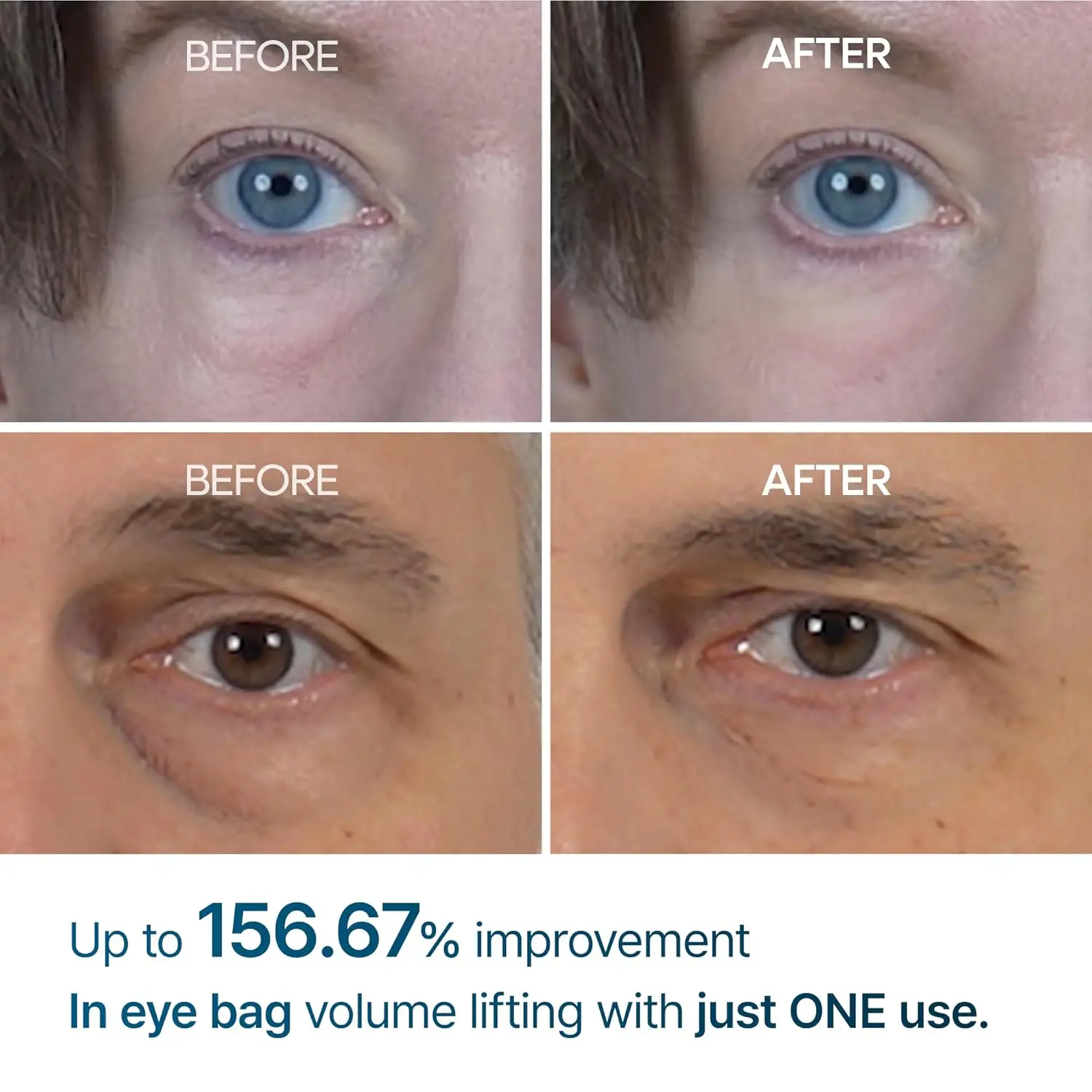 Dr Melaxin Eyephalt Eyebag Cream 10 gm - view 3