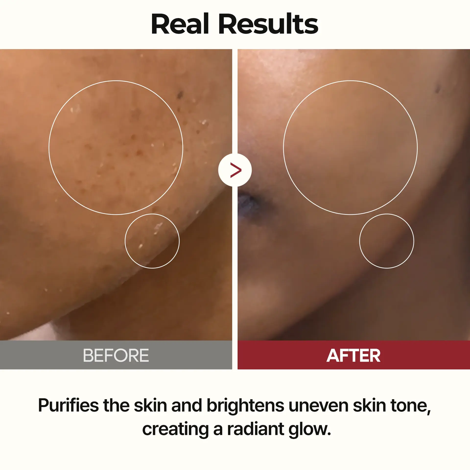 Dr Melaxin Peel Shot Glow Rice Toner 200 ml - view 7